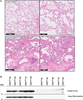 Impact of the Amyotrophic Lateral Sclerosis Disease on the Biomechanical Properties and Oxidative Stress Metabolism of the Lung Tissue Correlated With the Human Mutant SOD1G93A Protein Accumulation